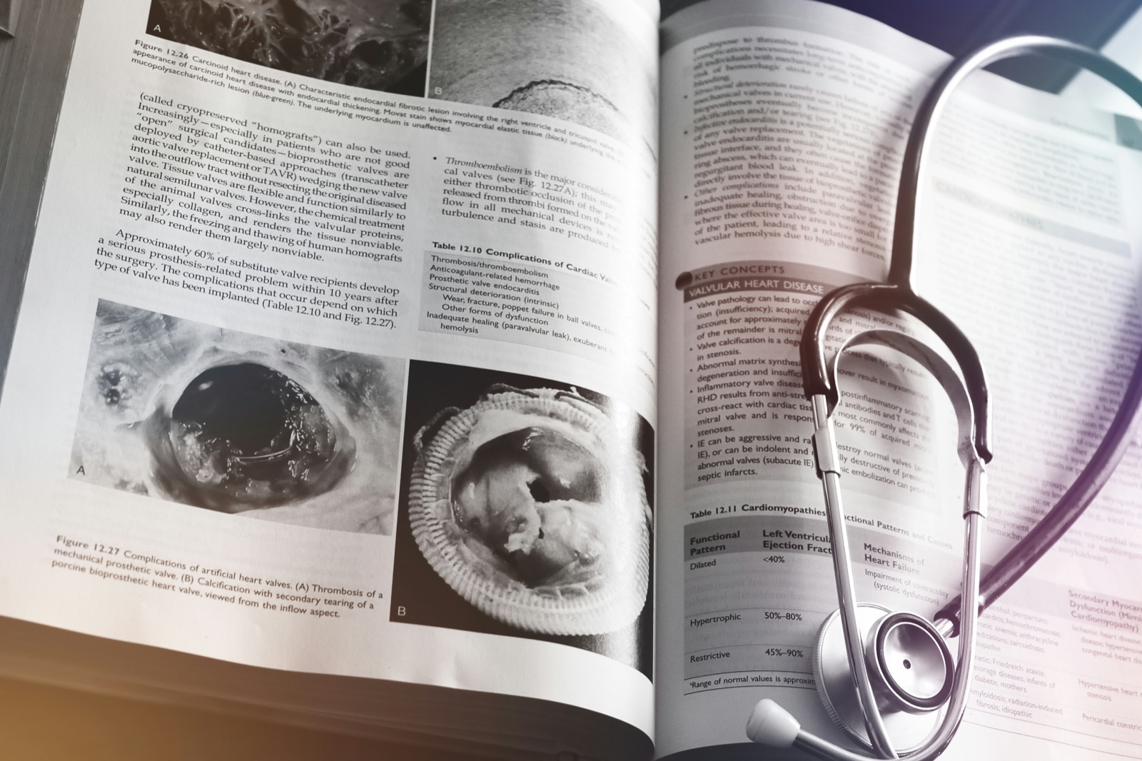 Tıp kitabı üzerinde stetoskop — klinik bilgi